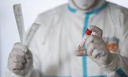 Coronavirus, in Italia 153 morti nelle ultime 24 ore
