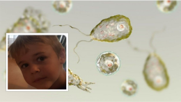Bimbo di 7 anni muore per infezione da ameba mangiacervello: «Stava nuotando nel lago»
