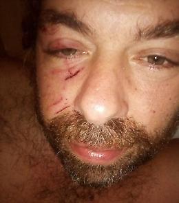 Ex consigliere comunale aggredito da una babygang