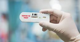 Covid, anticorpi guariti: qual è la durata dell'immunità
