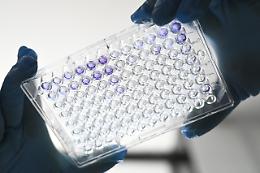 Covid, da vaccino Oxford «forte risposta immunitaria»