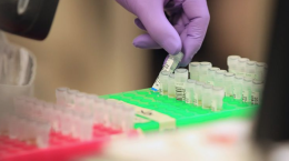 Coronavirus, combinati due farmaci in Francia: dati positivi sui pazienti