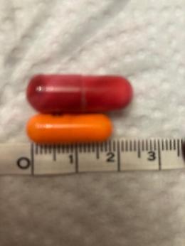 18enne affetta da rara sindrome cardiaca, l’Asl Napoli 3 Sud assicura la fornitura per un anno del farmaco salvavita