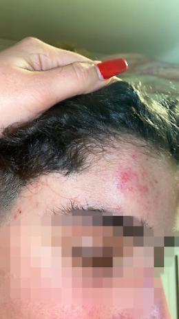 Sorpresi a urinare in un vicolo, ragazzi picchiati da baby-gang 