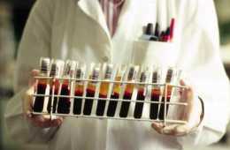 Contagiato da sangue infetto, condannato il Ministero