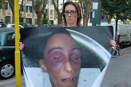 Caso Stefano Cucchi, difesa carabinieri: «A farlo morire sono stati i medici»