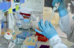 Vaiolo delle scimmie: primo caso in Toscana, 32enne ricoverato