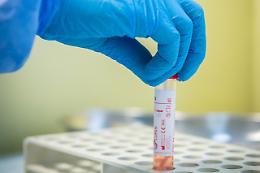 Coronavirus, in Italia 252 nuovi casi e 5 morti