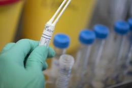 Covid, scienziati Hong Kong: «Primo caso confermato di reinfezione»