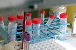 Coronavirus: primi casi in Liguria, Toscana e Sicilia