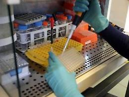 Negli Usa primo caso di batterio resistente a tutti gli antibiotici
