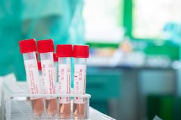 Report Covid: «Virus circola ancora, nuovi focolai»