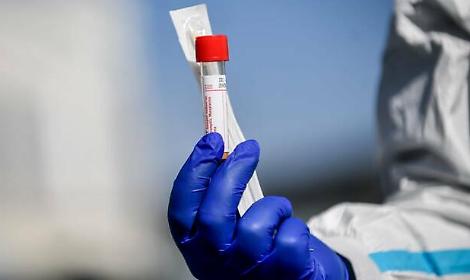 Ruolo delle vitamine del gruppo B nel nostro metabolismo